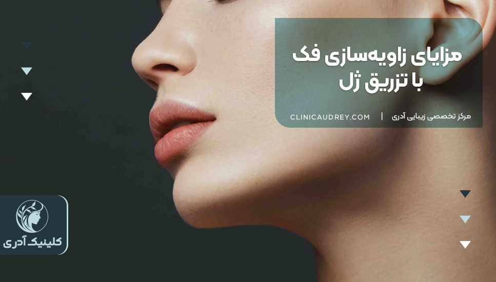 مزایای زاویهسازی فک با تزریق ژل