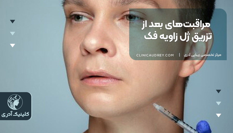 مراقبتهای بعد از تزریق ژل زاویه فک