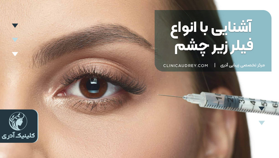 آشنایی با انواع فیلر زیر چشم 