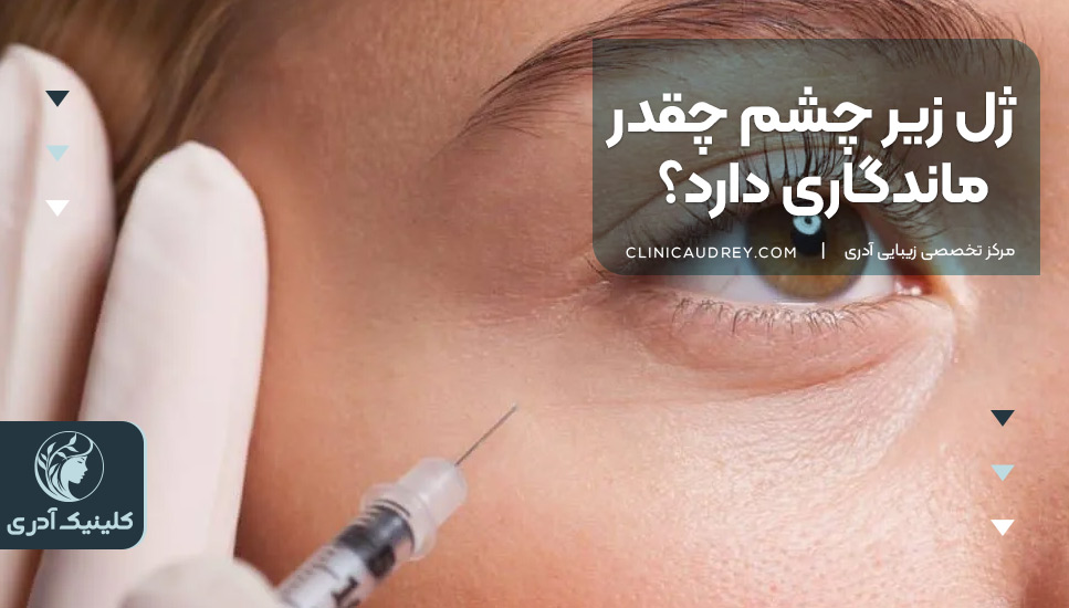 ژل زیر چشم چقدر ماندگاری دارد؟