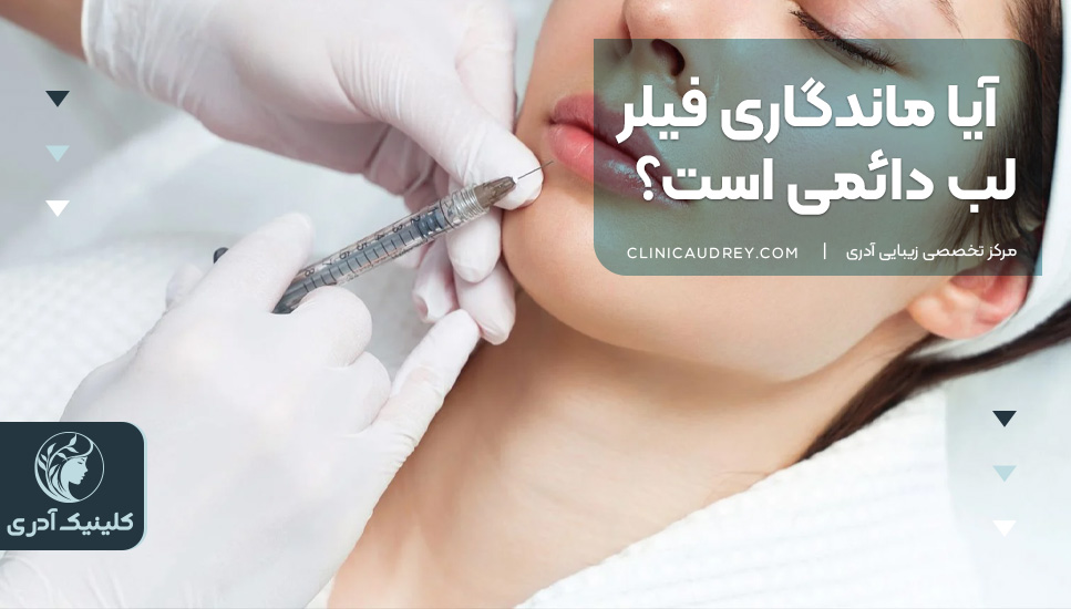 آیا ماندگاری فیلر لب دائمی است؟