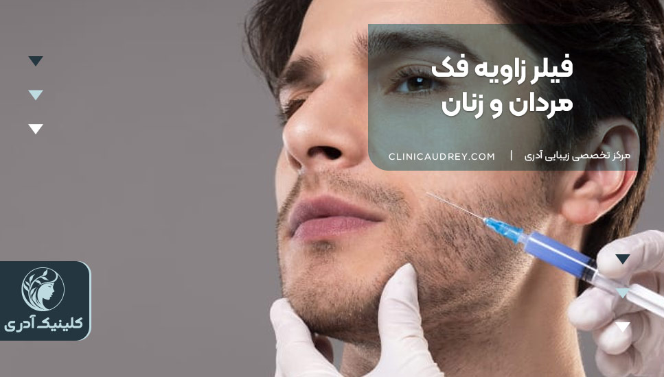 فیلر زاویه فک مردان و زنان