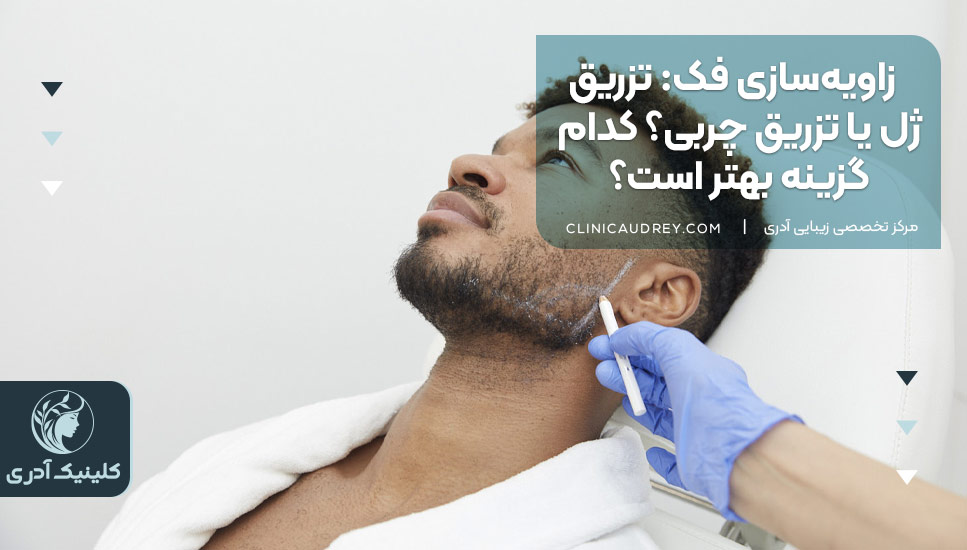 زاویهسازی فک: تزریق ژل یا تزریق چربی؟ کدام گزینه بهتر است؟