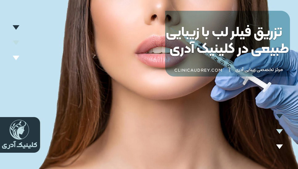 تزریق فیلر لب با زیبایی طبیعی در کلینیک آدری