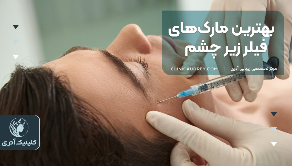 بهترین مارک‌های فیلر زیر چشم