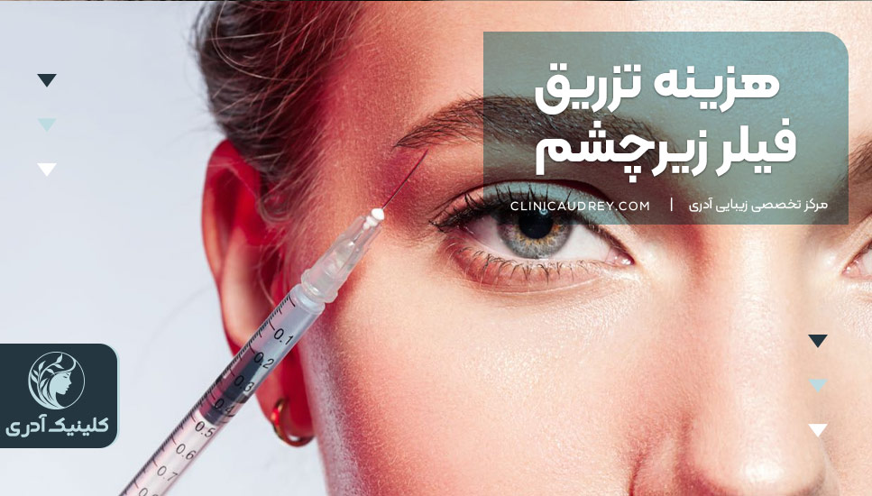 هزینه تزریق فیلر زیرچشم