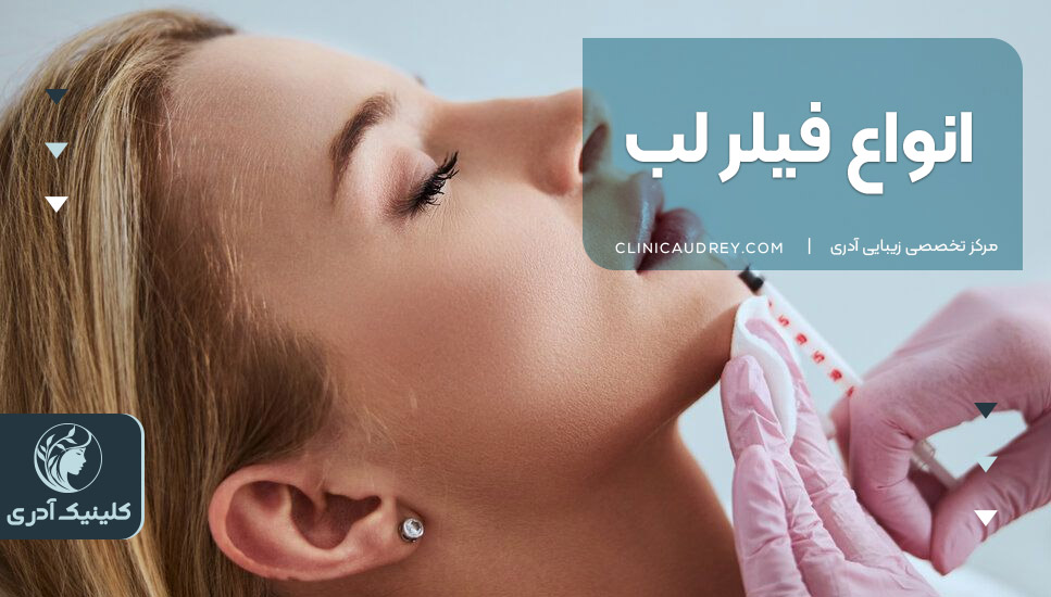 انواع فیلر لب