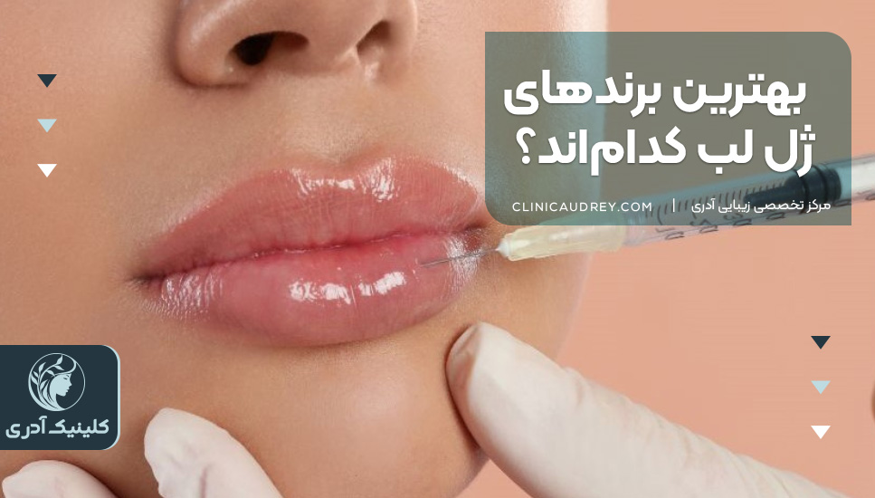 بهترین برندهای ژل لب کدام‌اند؟