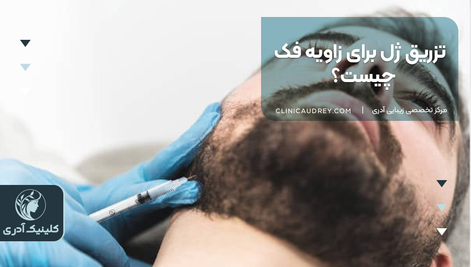 تزریق ژل برای زاویه فک چیست؟