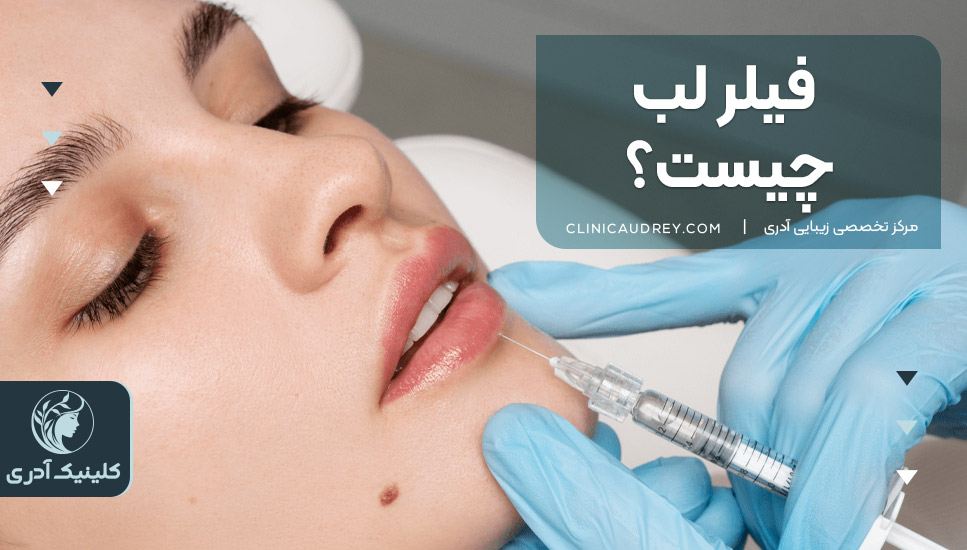فیلر لب چیست؟