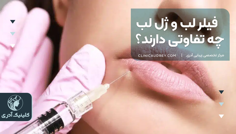 فیلر لب و ژل لب چه تفاوتی دارند؟