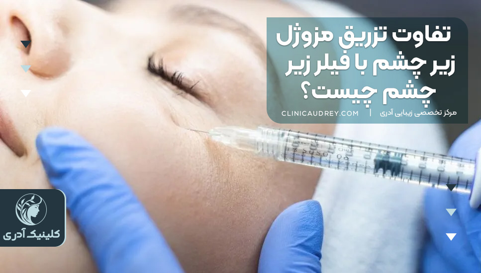 تفاوت تزریق مزوژل زیر چشم با فیلر زیر چشم چیست؟