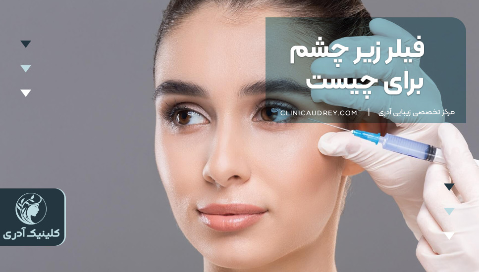 فیلر زیر چشم برای چیست؟