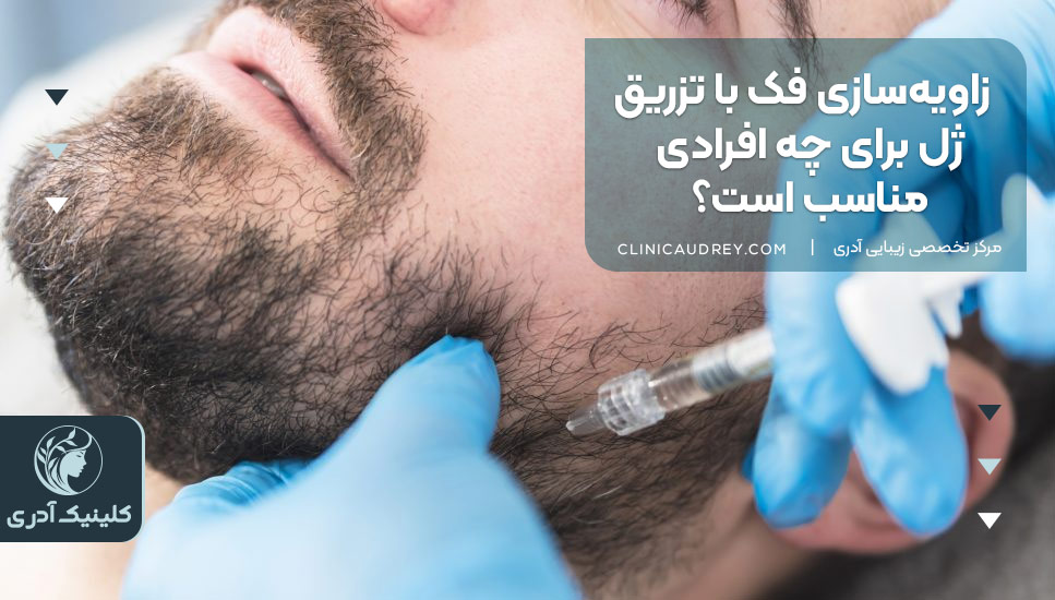 زاویهسازی فک با تزریق ژل برای چه افرادی مناسب است؟