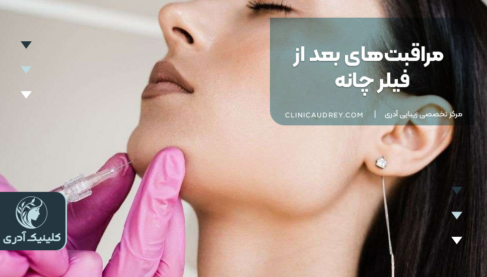 مراقبتهای بعد از فیلر چانه