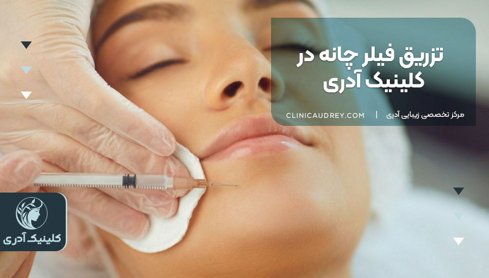 تزریق فیلر چانه در کلینیک آدری