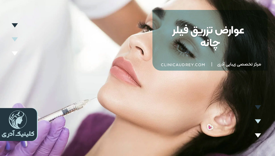 عوارض تزریق فیلر چانه