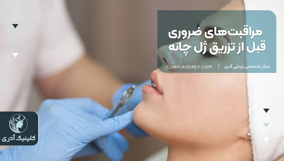 مراقبتهای ضروری قبل از تزریق ژل چانه