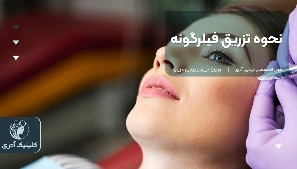 نحوه تزریق فیلرگونه