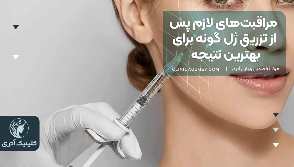 مراقبتهای لازم پس از تزریق ژل گونه برای بهترین نتیجه