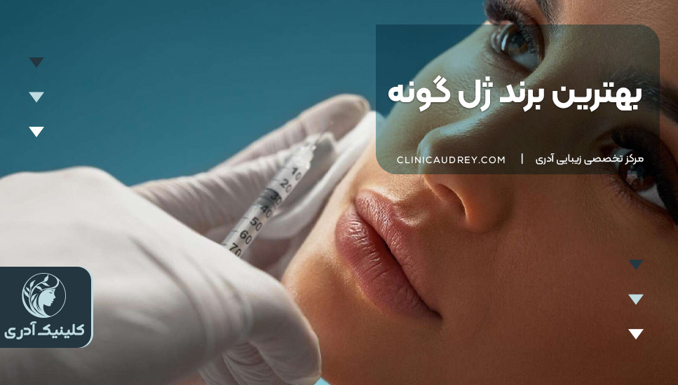 بهترین برند ژل گونه