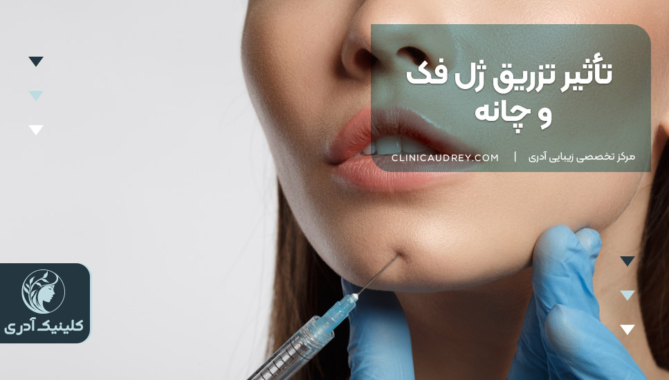 تأثیر تزریق ژل فک و چانه