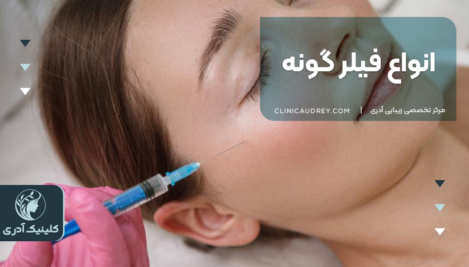 انواع فیلر گونه