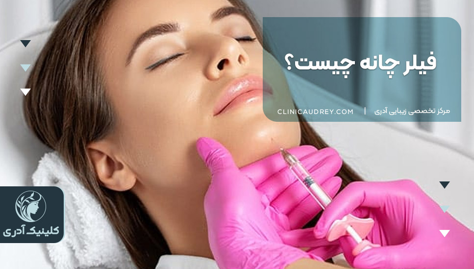فیلر چانه چیست؟