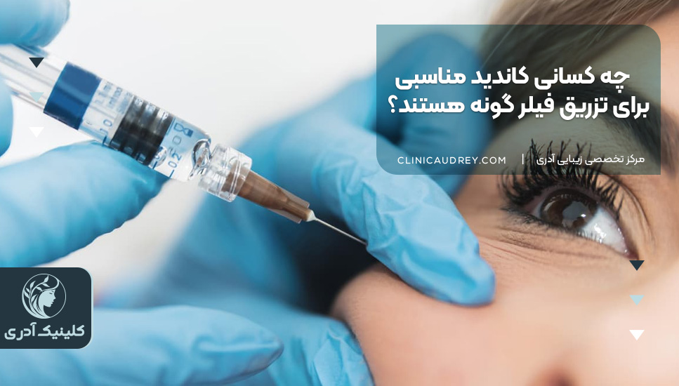 چه کسانی کاندید مناسبی برای تزریق فیلر گونه هستند؟