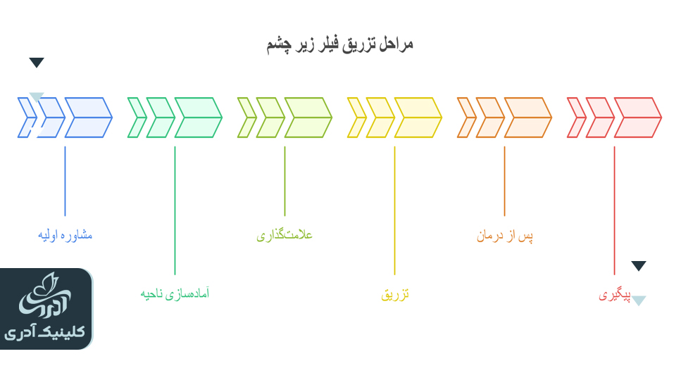 مراحل تزریق فیلر زیر چشم چگونه انجام می‌شود؟