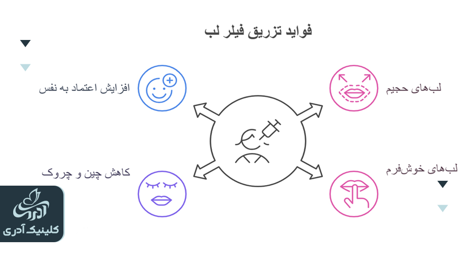 فواید تزریق فیلر لب چیست؟