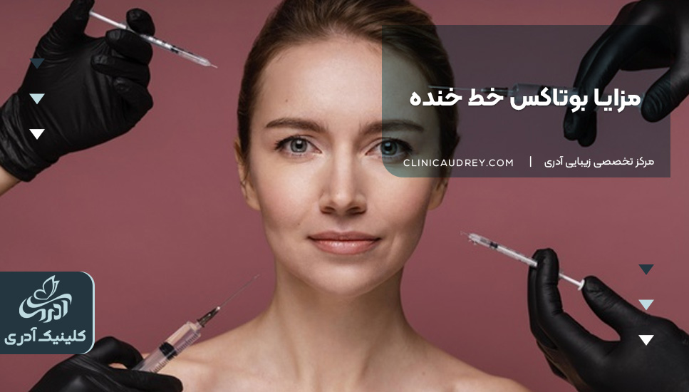 مزایا بوتاکس خط خنده