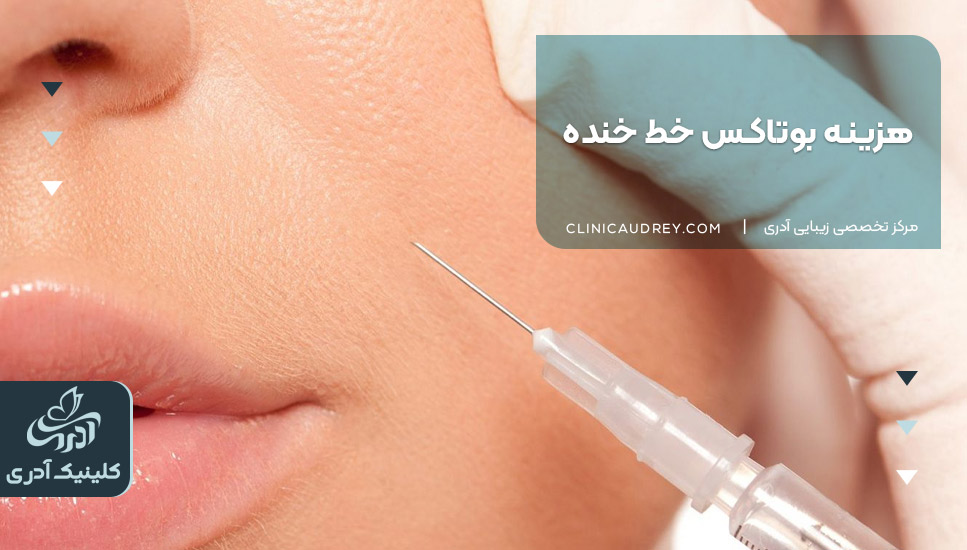 هزینه بوتاکس خط خنده