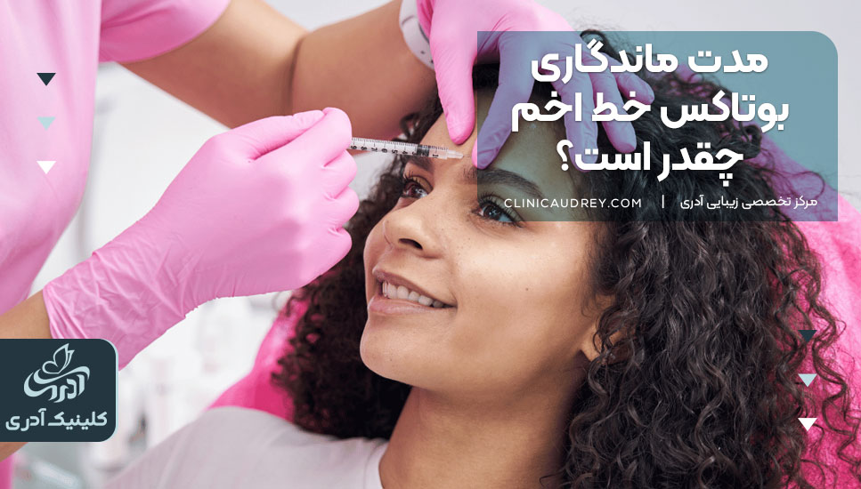 مدت ماندگاری بوتاکس خط اخم چقدر است؟