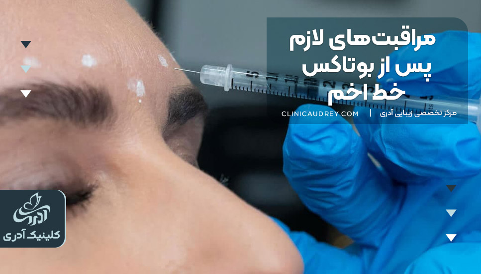 مراقبت‌های لازم پس از بوتاکس خط اخم