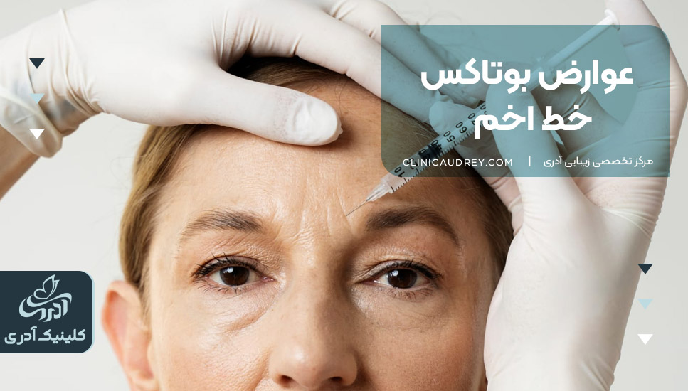 عوارض بوتاکس خط اخم