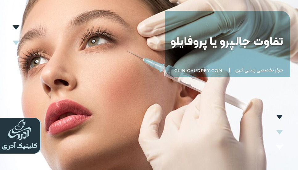 تفاوت جالپرو یا پروفایلو 