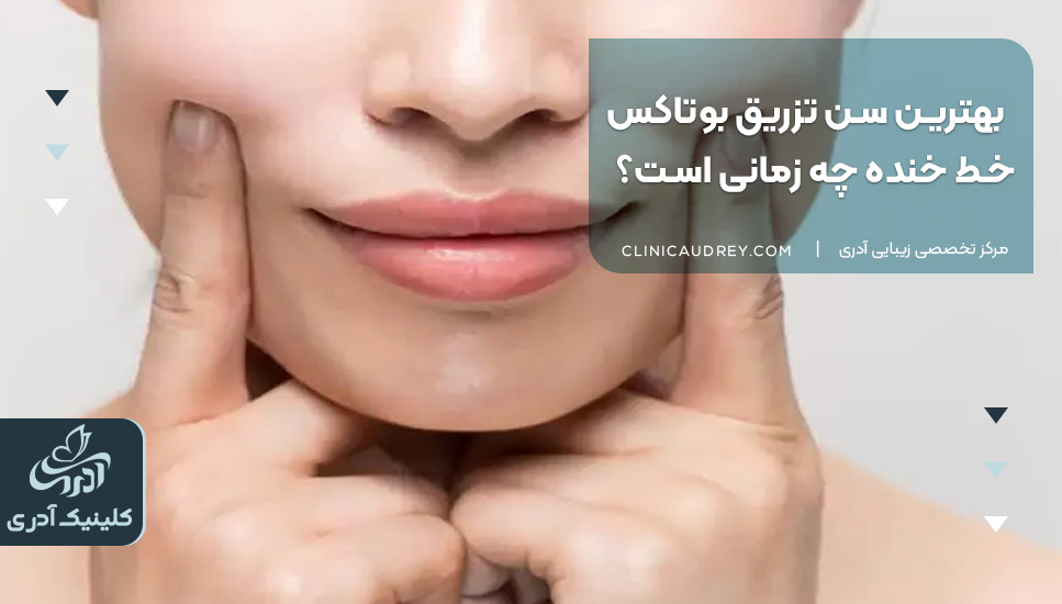 بهترین سن تزریق بوتاکس خط خنده چه زمانی است؟