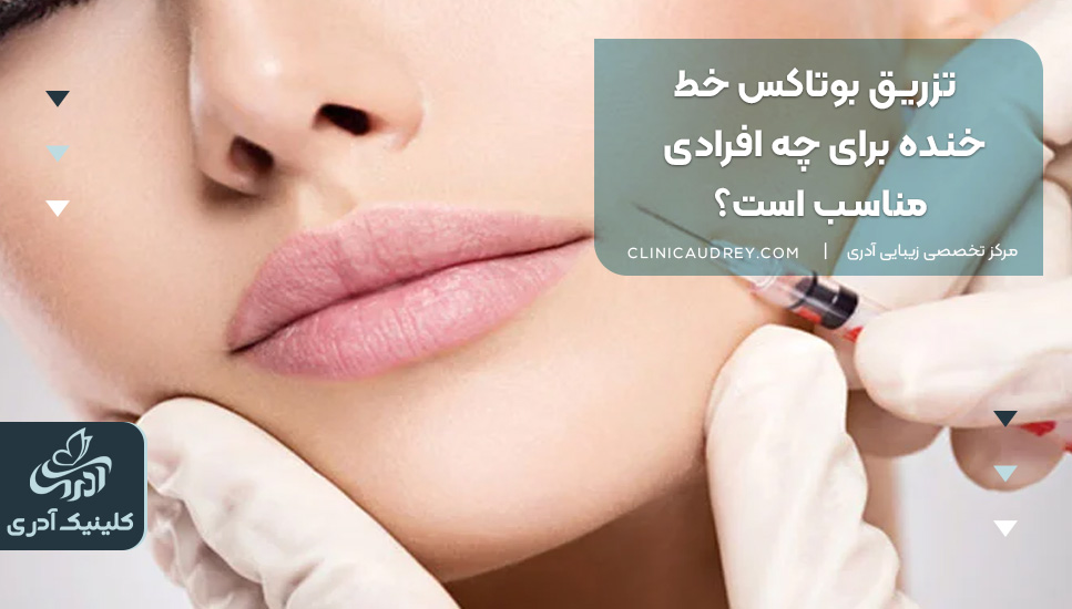 کیا بوتاکس خط خنده انجام دادن