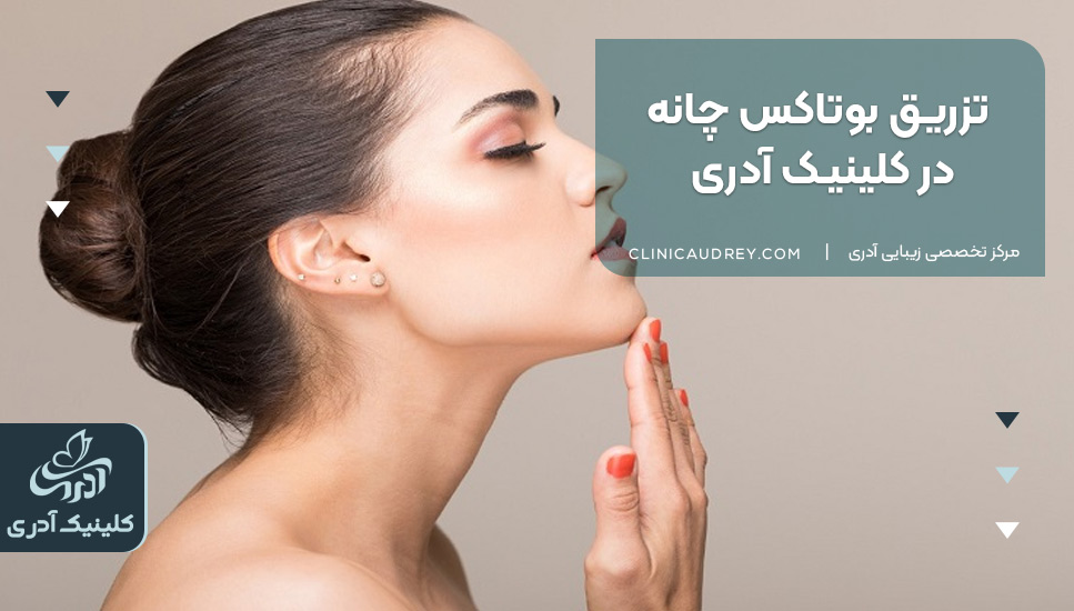 تزریق بوتاکس چانه در کلینیک آدری