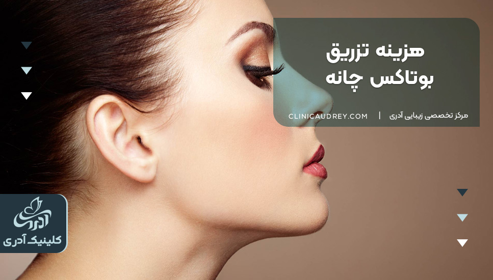 هزینه تزریق بوتاکس چانه