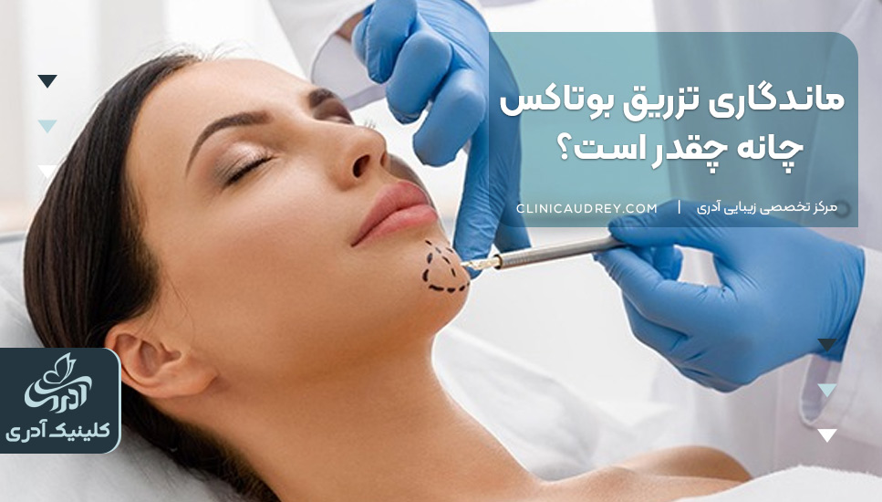 ماندگاری تزریق بوتاکس چانه چقدر است؟