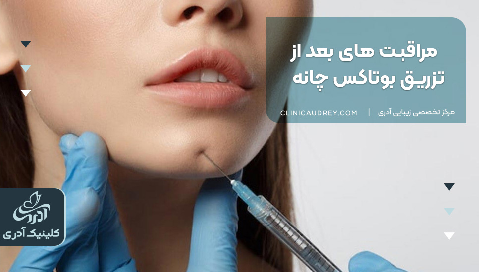 مراقبت‌های بعد از تزریق بوتاکس چانه