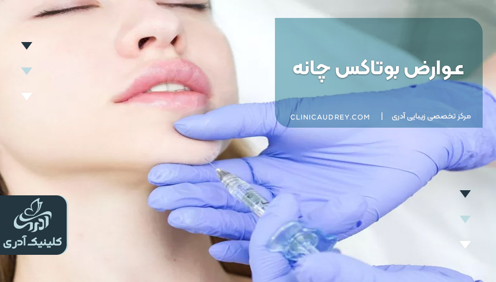 عوارض بوتاکس چانه