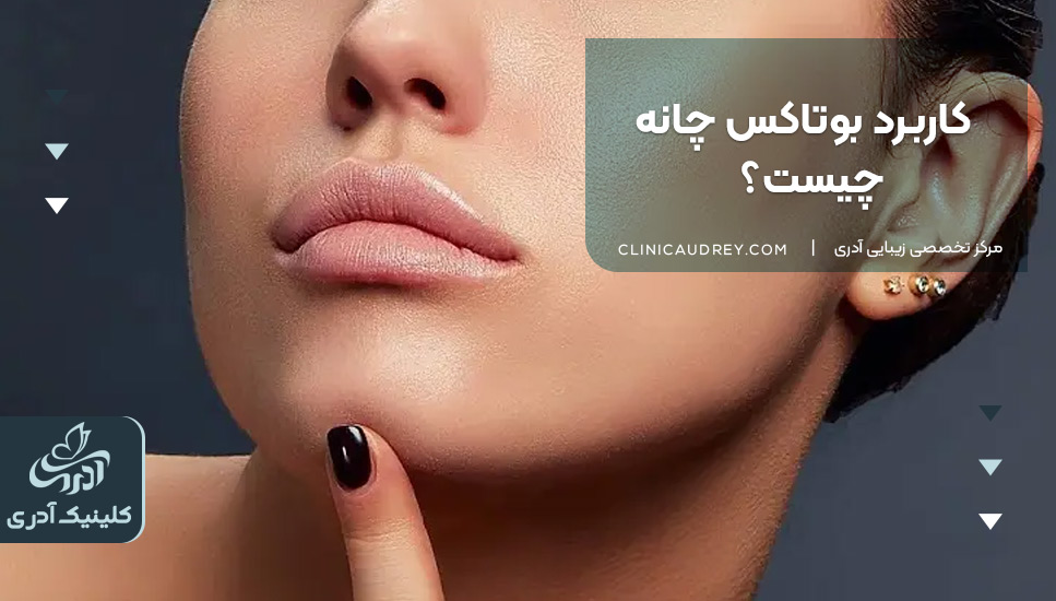 کاربرد بوتاکس چانه چیست؟