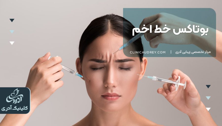 بوتاکس خط اخم | مزایا و عوارض بوتاکس خط اخم [+هزینه تزریق 1404]