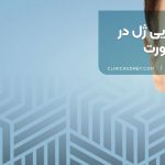 جابجایی ژل در صورت