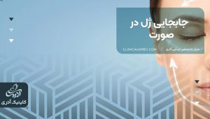 جابجایی ژل در صورت