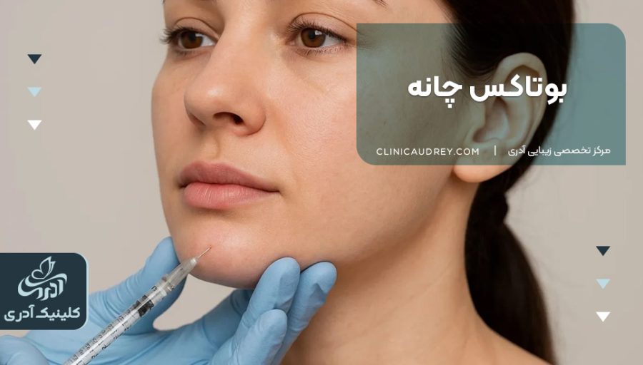 بوتاکس چانه | مزایا و عوارض بوتاکس چانه